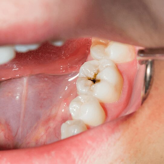 family dentist in rapid city